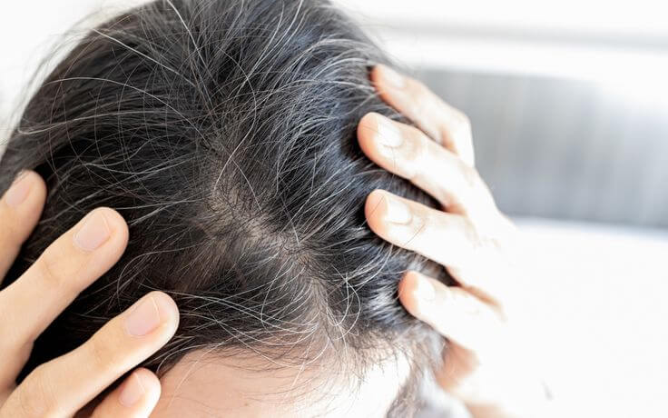 How Can I Slow Down Hair Graying?
