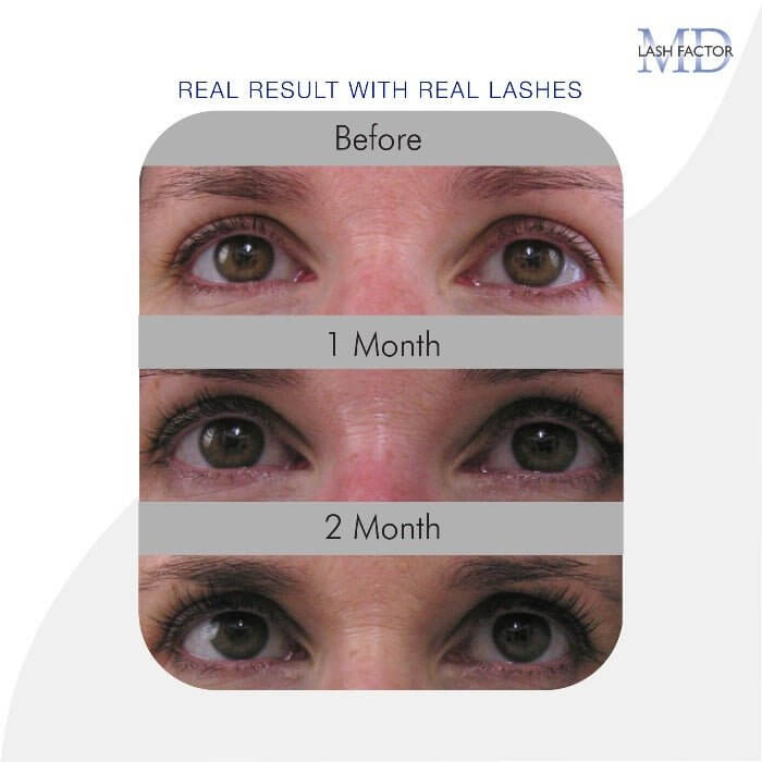 Progressive lash results: before use, after 1 month, and longer, fuller lashes at 2 months with MD Lash Factor 3-Month Supply