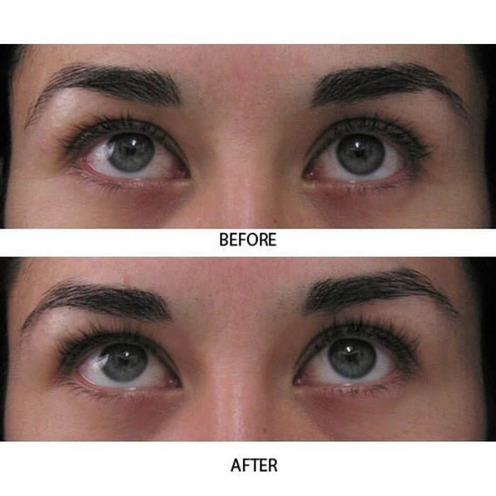 Before and after photo of young woman showing visibly longer, fuller lashes after 4 weeks of using MD Lash Factor Eyelash Conditioner – lash growth serum by MD Lash